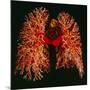 Resin Cast of Pulmonary Arteries And Bronchi-Martin Dohrn-Mounted Photographic Print