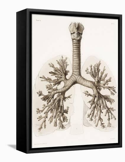 Respiratory Anatomy, 19th Century Artwork-Science Photo Library-Framed Stretched Canvas