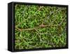 Retina Blood Vessel And Nerve Cells-Thomas Deerinck-Framed Stretched Canvas