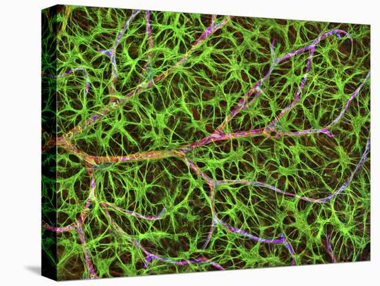 Retina Blood Vessel And Nerve Cells-Thomas Deerinck-Stretched Canvas