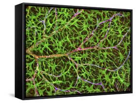 Retina Blood Vessel And Nerve Cells-Thomas Deerinck-Framed Stretched Canvas