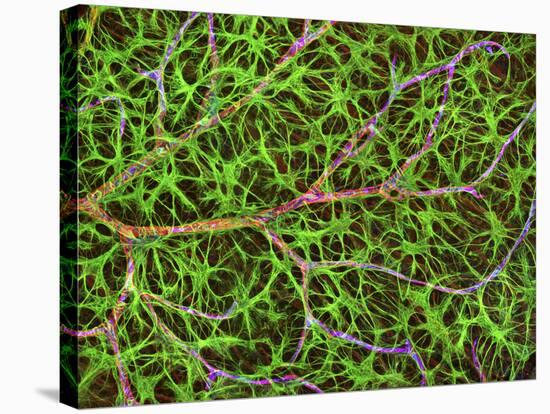 Retina Blood Vessel And Nerve Cells-Thomas Deerinck-Stretched Canvas