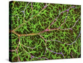 Retina Blood Vessel And Nerve Cells-Thomas Deerinck-Stretched Canvas