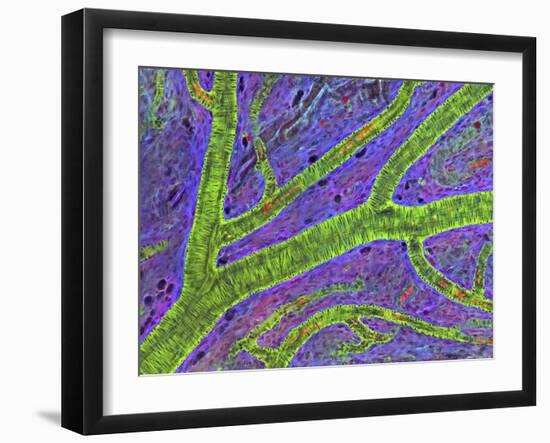 Retina Blood Vessel-Thomas Deerinck-Framed Photographic Print