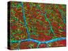 Retina Blood Vessels And Nerve Cells-Thomas Deerinck-Stretched Canvas
