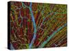 Retina Blood Vessels And Nerve Cells-Thomas Deerinck-Stretched Canvas