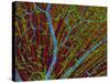 Retina Blood Vessels And Nerve Cells-Thomas Deerinck-Stretched Canvas