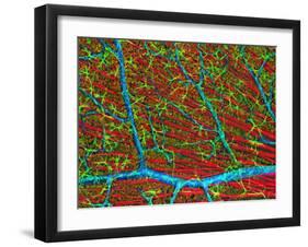 Retina Blood Vessels And Nerve Cells-Thomas Deerinck-Framed Photographic Print