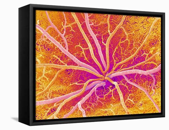 Retina Blood Vessels, SEM-Susumu Nishinaga-Framed Stretched Canvas