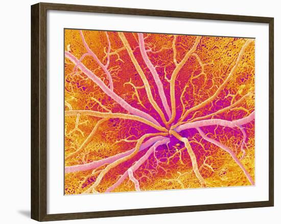 Retina Blood Vessels, SEM-Susumu Nishinaga-Framed Photographic Print