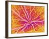 Retina Blood Vessels, SEM-Susumu Nishinaga-Framed Photographic Print