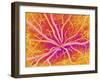 Retina Blood Vessels, SEM-Susumu Nishinaga-Framed Photographic Print