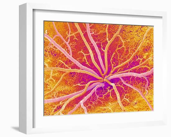 Retina Blood Vessels, SEM-Susumu Nishinaga-Framed Photographic Print