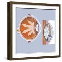 Retina of Eye with Glaucoma-null-Framed Art Print