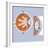 Retina of Eye with Glaucoma-null-Framed Art Print