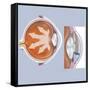 Retina of Eye with Glaucoma-null-Framed Stretched Canvas