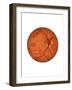 Retina with Neovascularization-null-Framed Art Print