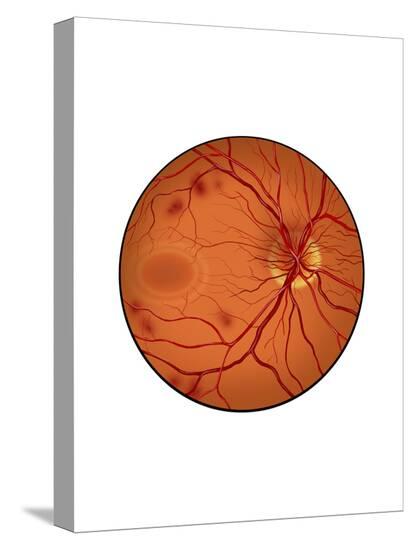 Stretched Canvas Print, , large