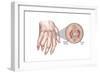 Rheumatoid Arthritis-Spencer Sutton-Framed Art Print