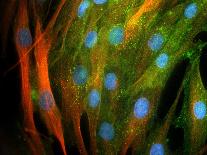 Brain Cells In Culture, Light Micrograph-Riccardo Cassiani-ingoni-Photographic Print