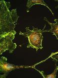 Nerve Cells-Riccardo Cassiani-ingoni-Photographic Print