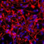 Neural Stem Cells In Culture-Riccardo Cassiani-ingoni-Framed Premium Photographic Print