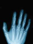 X-Ray of a Hand-Robert Llewellyn-Photographic Print