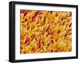 Rod and Cone Layer of Retina of Rabbit-Micro Discovery-Framed Premium Photographic Print