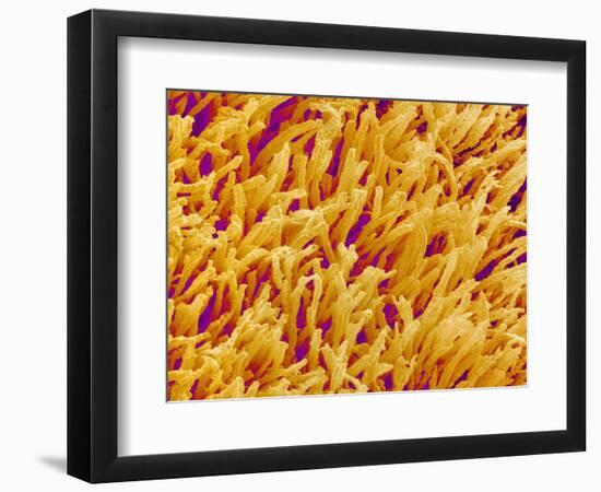 Rod and Cone Layer of Retina of Rabbit-Micro Discovery-Framed Photographic Print