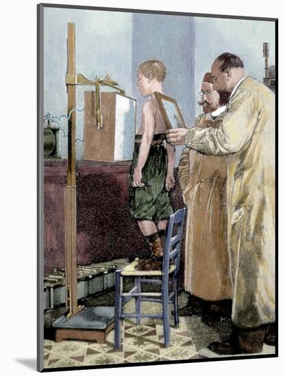 Rontgen, Wilhelm Conrad (1845-1923). German Physicist. Rontgen Exploring a Child with X-Ray Device-Tarker-Mounted Giclee Print
