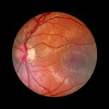 Fundus Camera Image of a Normal Retina, Caucasian-Rory McClenaghan-Premium Photographic Print