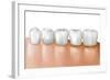 Row of Teeth Showing Gingivitis-null-Framed Art Print