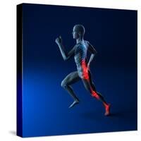 Running Injuries, Conceptual Artwork-SCIEPRO-Stretched Canvas