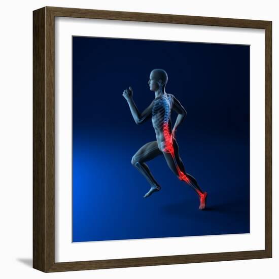 Running Injuries, Conceptual Artwork-SCIEPRO-Framed Premium Photographic Print