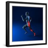 Running Injuries, Conceptual Artwork-SCIEPRO-Framed Premium Photographic Print