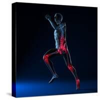 Running Injuries, Conceptual Artwork-SCIEPRO-Stretched Canvas