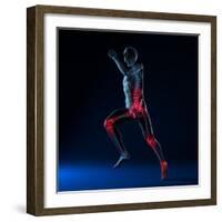 Running Injuries, Conceptual Artwork-SCIEPRO-Framed Premium Photographic Print