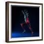 Running Injuries, Conceptual Artwork-SCIEPRO-Framed Premium Photographic Print