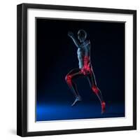 Running Injuries, Conceptual Artwork-SCIEPRO-Framed Premium Photographic Print