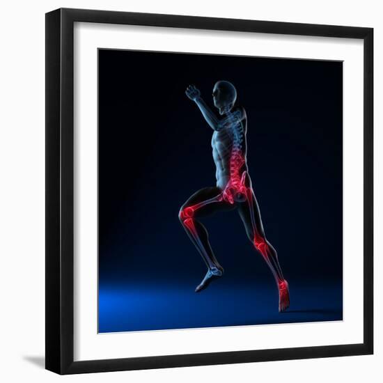 Running Injuries, Conceptual Artwork-SCIEPRO-Framed Premium Photographic Print