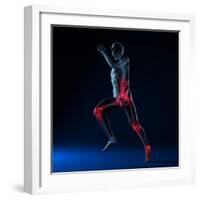 Running Injuries, Conceptual Artwork-SCIEPRO-Framed Premium Photographic Print