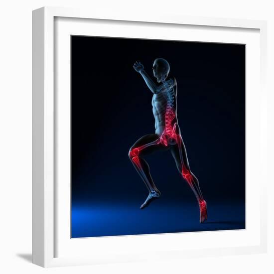 Running Injuries, Conceptual Artwork-SCIEPRO-Framed Premium Photographic Print