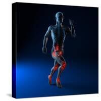 Running Injuries, Conceptual Artwork-SCIEPRO-Stretched Canvas