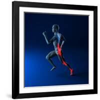 Running Injuries, Conceptual Artwork-SCIEPRO-Framed Photographic Print