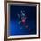 Running Injuries, Conceptual Artwork-SCIEPRO-Framed Photographic Print