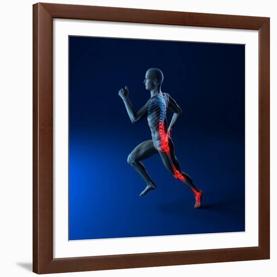 Running Injuries, Conceptual Artwork-SCIEPRO-Framed Photographic Print