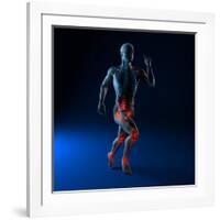 Running Injuries, Conceptual Artwork-SCIEPRO-Framed Photographic Print