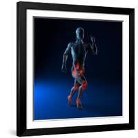 Running Injuries, Conceptual Artwork-SCIEPRO-Framed Photographic Print