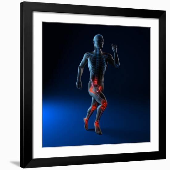 Running Injuries, Conceptual Artwork-SCIEPRO-Framed Photographic Print