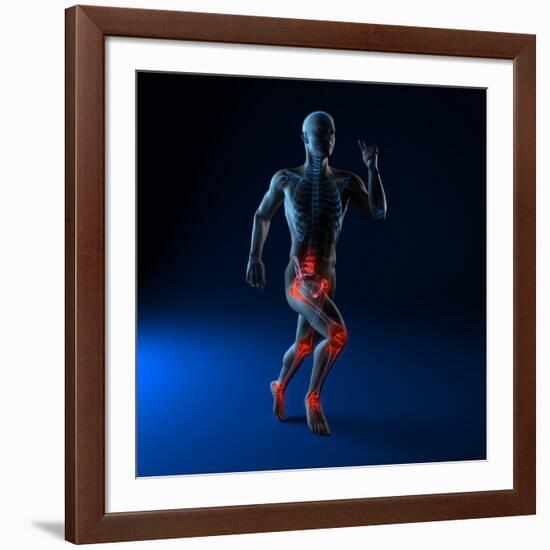 Running Injuries, Conceptual Artwork-SCIEPRO-Framed Photographic Print